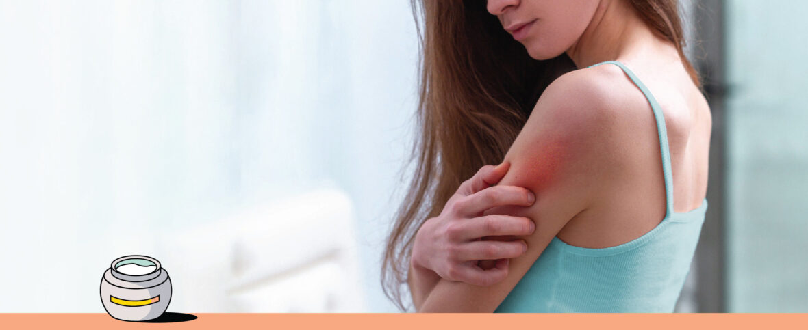 Heat Rash: Pictures, Treatment, and Prevention