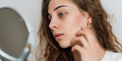 What Causes Rosacea? Treatments, Medications and More